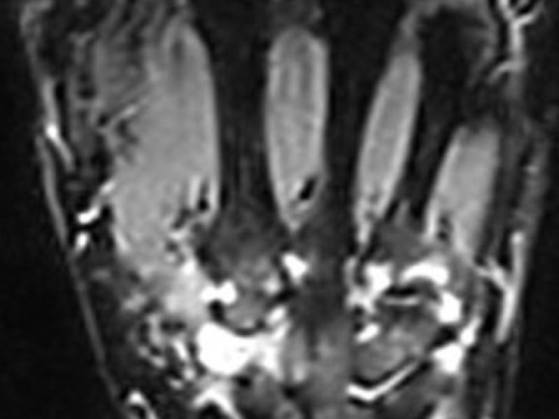 abb6.jpg
